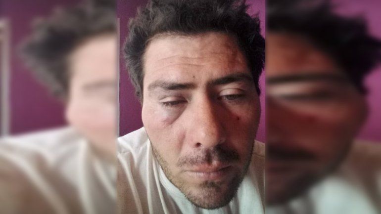 Compró un auto por Face, fue a reclamar porque no andaba y le dieron una golpiza