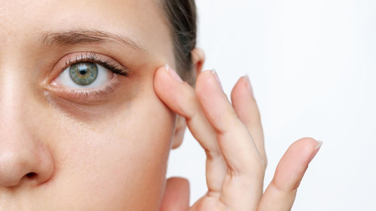 Adiós a las ojeras: el truco sencillo y efectivo con manzanilla para eliminarlas