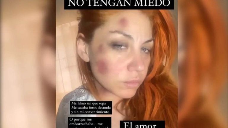 En 2023 Lourdes de Bandana había denunciado a su novio Leandro García Gómez por violencia de género.