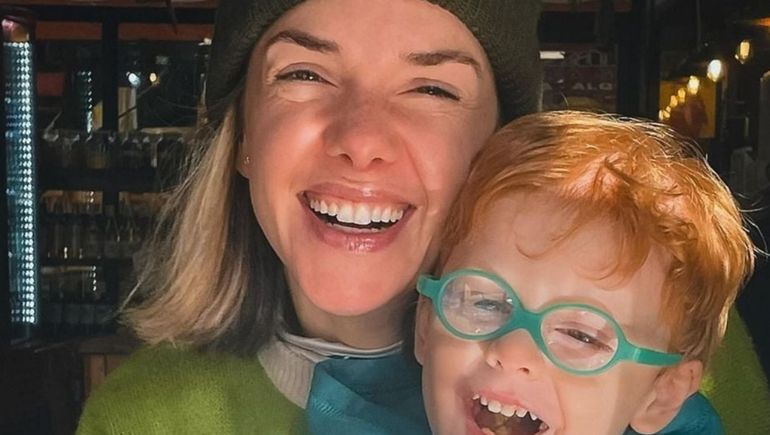 Julieta Nair Calvo contó por qué su hijo tiene que vivir con un parche en el ojo