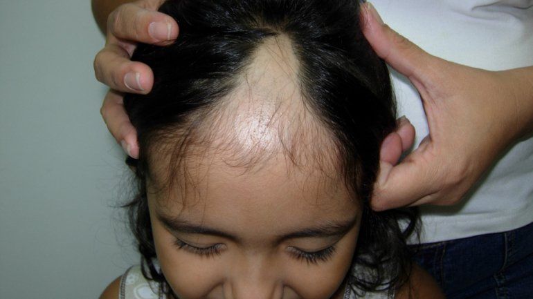 Este tipo de conductas suelen ir desapareciendo con ayuda psicológica y a medida que la persona crece. Pocas veces pasa a ser un caso psiquiátrico.