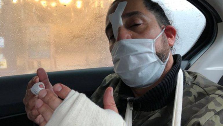 Un delincuente murió en un intento de robo en Flores