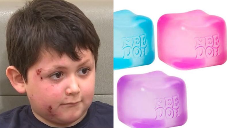 Intentó hacer un reto viral en las redes sociales y sufrió graves quemaduras | LM Neuquen Intentó hacer un reto viral en las redes sociales y sufrió graves quemaduras