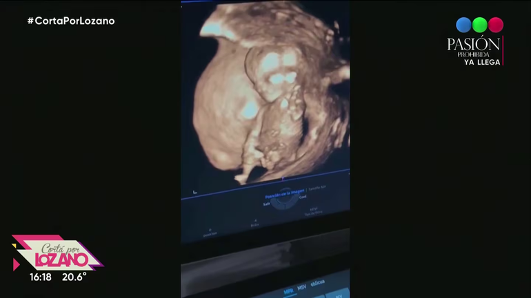 La ecografía de Sol Pérez. La ecografía de Sol Pérez.