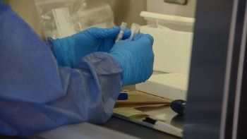 argentina supero las 100 muertes por coronavirus argentina supero las 100 muertes por coronavirus