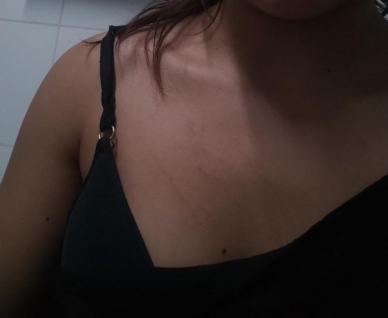 Las lesiones que recibió una de las víctimas al ser arrastrada y golpeada por los delincuentes. Las lesiones que recibió una de las víctimas al ser arrastrada y golpeada por los delincuentes.