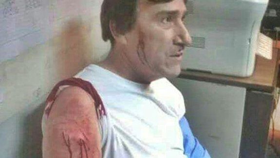 Lo hirieron en el brazo izquierdo y en la cara con un arma blanca.