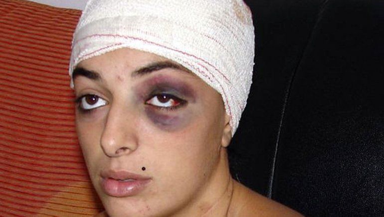 Salvaje: su pareja le abrió la cabeza de un hachazo