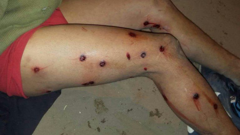 Noche violenta: palazos y balas de gomas en un enfrentamiento entre vecinos y la Policía 