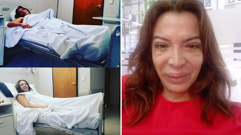 Lizy Tagliani mostró su nueva cara tras la cirugía