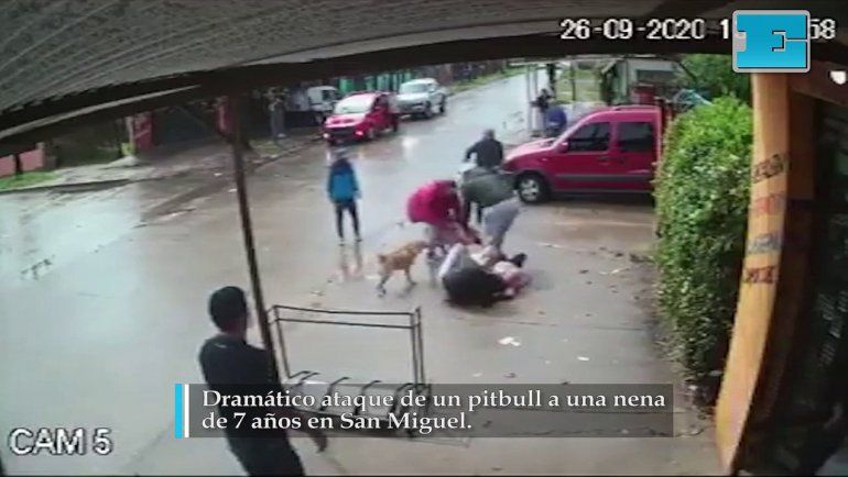 Video: terrible ataque de un pitbull a una nena de 7 años