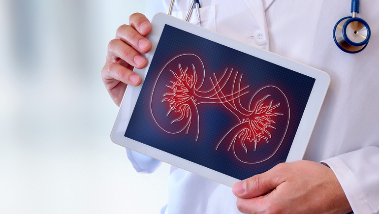 Día mundial del cáncer de riñón: avanzan terapias