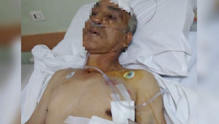 Apuñalaron a un hombre de 69 años en un intento de robo
