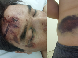 Sebastián es uno de los petroleros que fueron chocados en Ruta 51 y terminó internado en terapia intensiva durante seis días. Sebastián es uno de los petroleros que fueron chocados en Ruta 51 y terminó internado en terapia intensiva durante seis días.