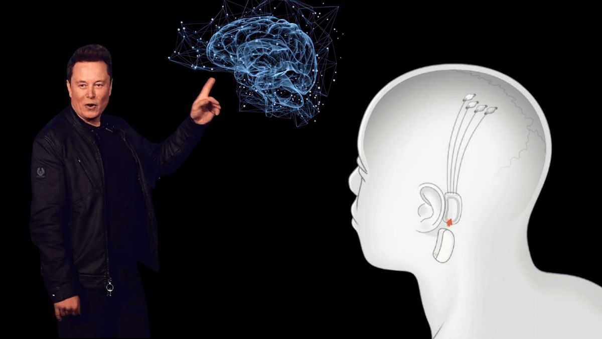 Elon Musk Comparte Un Video Del Primer Paciente De Neuralink