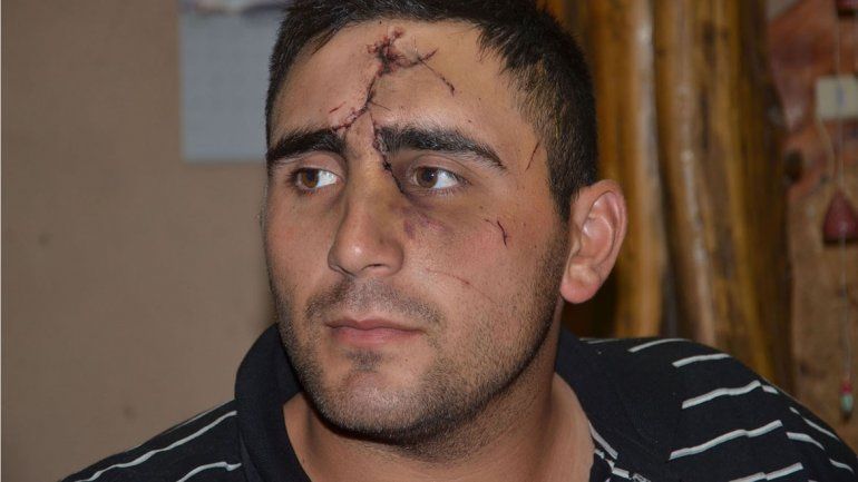 Le desfiguraron la cara por hacerse policía