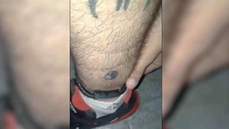 Preso avisó que su tobillera estaba fallada y desapareció