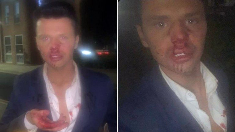 Brutal ataque homofóbico al Ken humano en un bar