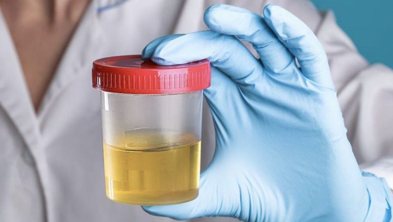 Análisis de orina al intendente y todos los funcionarios, el proyecto que discute una ciudad de Santa Cruz