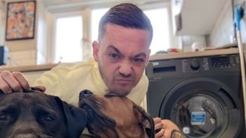 El hombre tiene ahora 33 años y se encuentra mucho mejor gracias a un dispositivo que le implantaron quirúrgicamente. El hombre tiene ahora 33 años y se encuentra mucho mejor gracias a un dispositivo que le implantaron quirúrgicamente.