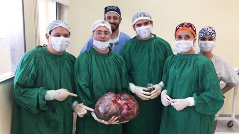 Le extirparon un tumor de 15 kilos a una mujer