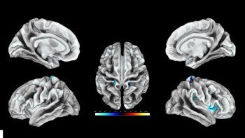 área del cerebro correspondiente al clítoris.jpg