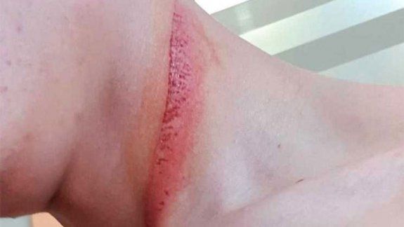 Deniz Öncü casi se corta el cuello con el disco de freno delantero de un rival