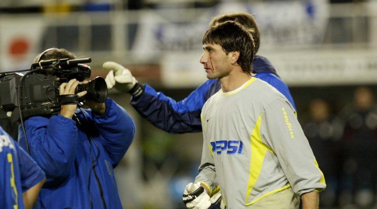 Las heridas en el rostro de&nbsp;Abbondanzieri.