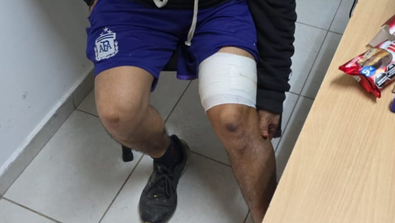 La puñalada le dejó al joven una herida en el muslo de la pierna derecha. 
