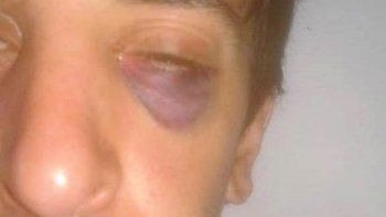 motochorros casi mataron a golpes a un joven, pero ya estan libres motochorros casi mataron a golpes a un joven, pero ya estan libres