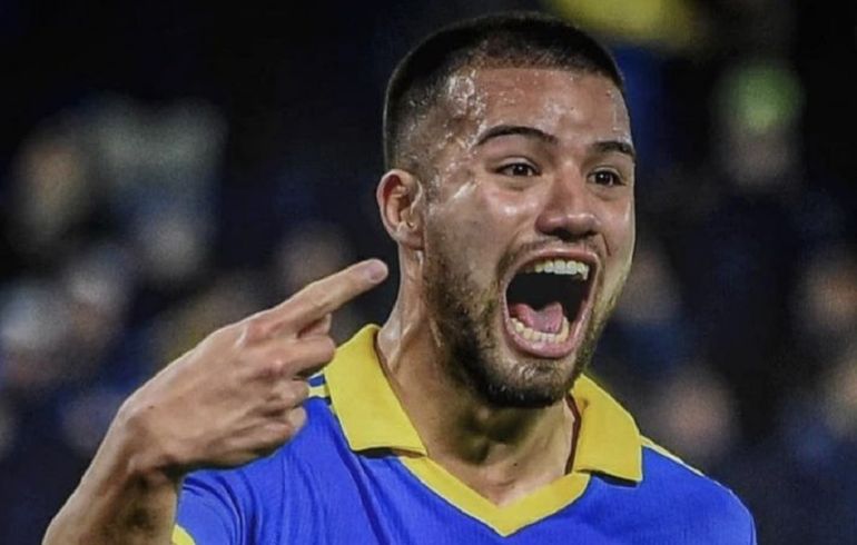 Revuelo y memes en las redes por el retoque de labios del Chelo Weigandt