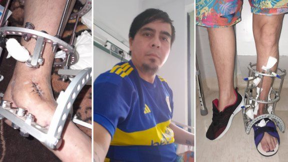 No da más: Pablo suplica por la cirugía definitiva para vivir con dignidad