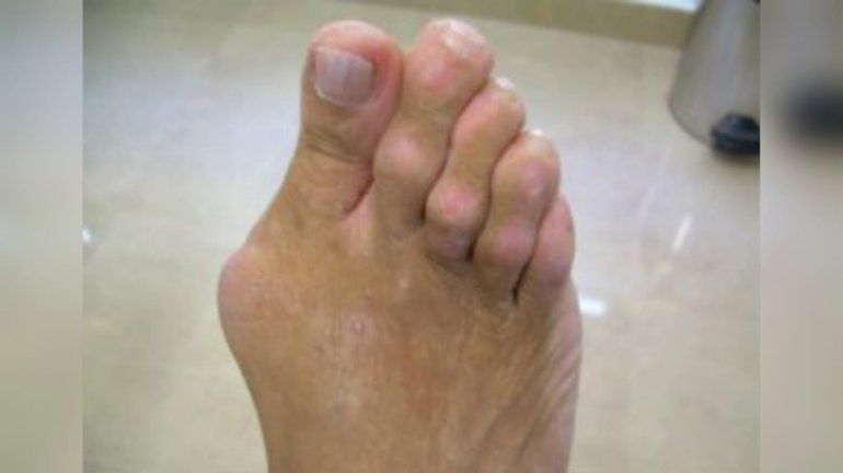 Foto ilustrativa.&nbsp;