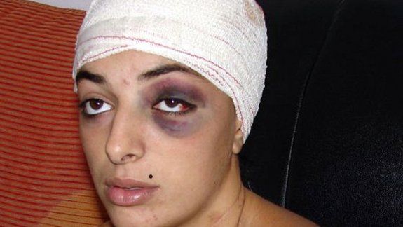 Salvaje: su pareja le abrió la cabeza de un hachazo