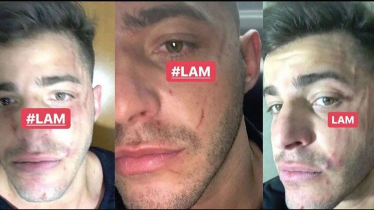 Destrozado. Lhoan le envió a De Brito fotos de cómo había quedado su rostro.