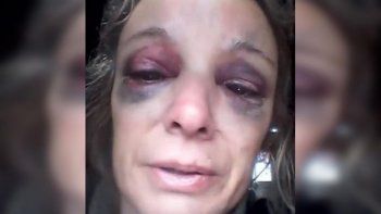 desgarrador: se nego a tener sexo y le partio un ladrillo en la cabeza