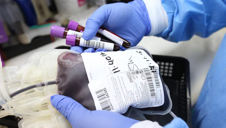 Fin del pedido de donantes para cirugías: los cambios clave en el nuevo sistema nacional de sangre