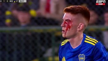 El Colo Barco debió ser suturado en el vestuario. El Colo Barco debió ser suturado en el vestuario.