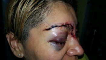 ataco a golpes a su mama y desfiguro a una sargento