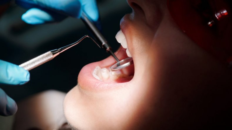 Obras sociales y prepagas: ¿por qué sale tan caro ir al dentista?