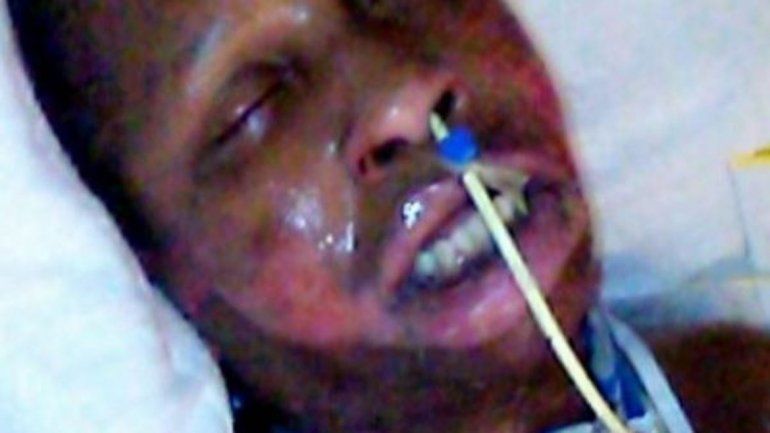 La mujer tiene siete hijos y está internada en gravísimo estado.