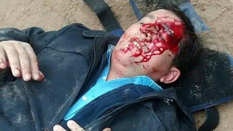 El subcomisario Flavio González fue atacado por un delincuente que le pegó con un fierro en la cabeza.