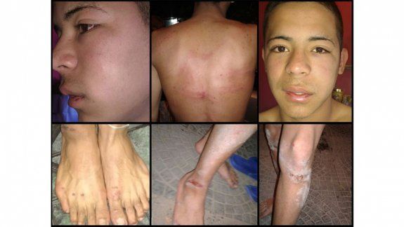 oficiales están detenidos, acusados de tormentos y robo con armas.