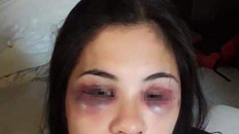 Tras los festejos por Año Nuevo, le desfiguró la cara a su novia y la cortó con un vidrio