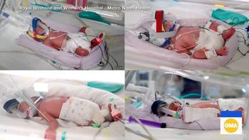 El nacimiento múltiple tuvo lugar en un hospital del estado de Queensland, en Australia.