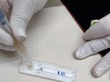 En Río Negro: ofrecen un test gratuito para detectar cáncer colorrectal