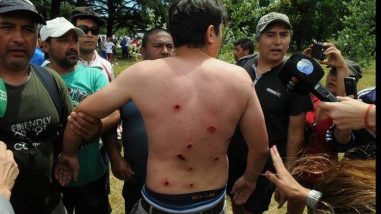 Reprimieron a trabajadores que pedían ser reincorporados al Municipio