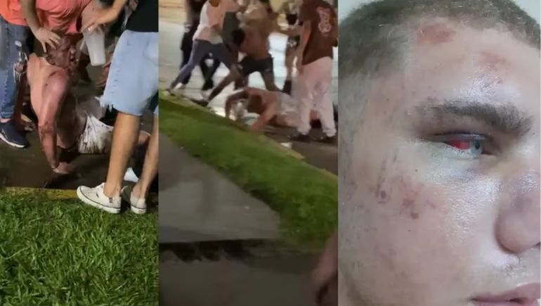 Brutal golpiza a un adolescente de 17 años a la salida de un boliche