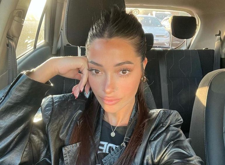 Tiziana Sabatini se retocó la nariz y está feliz con el resultado. Tiziana Sabatini se retocó la nariz y está feliz con el resultado.