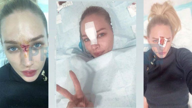 Mirá el tremendo accidente de Belén Pouchan haciendo acrobacias